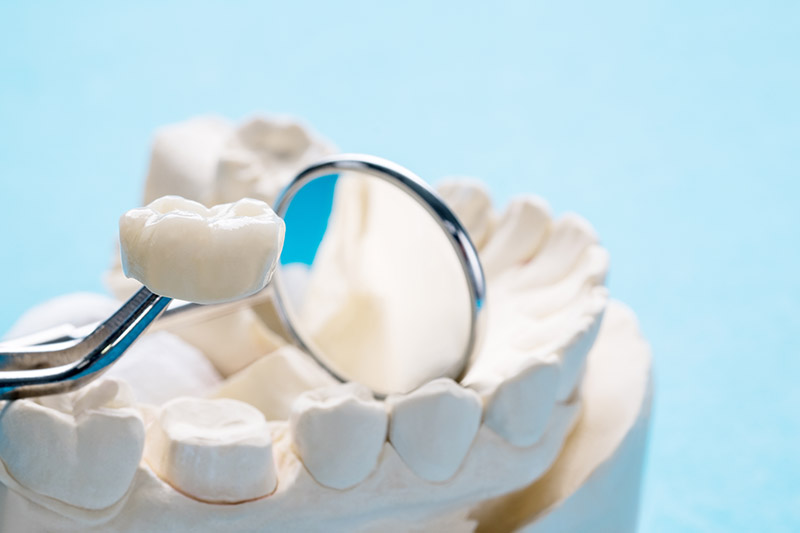 Memorial Dental Care Special Offer