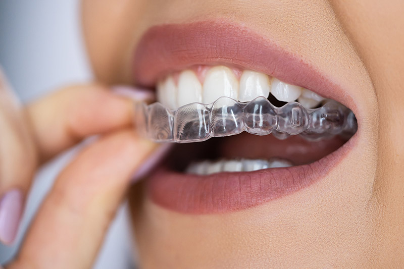 Orthodontics in Cape Coral